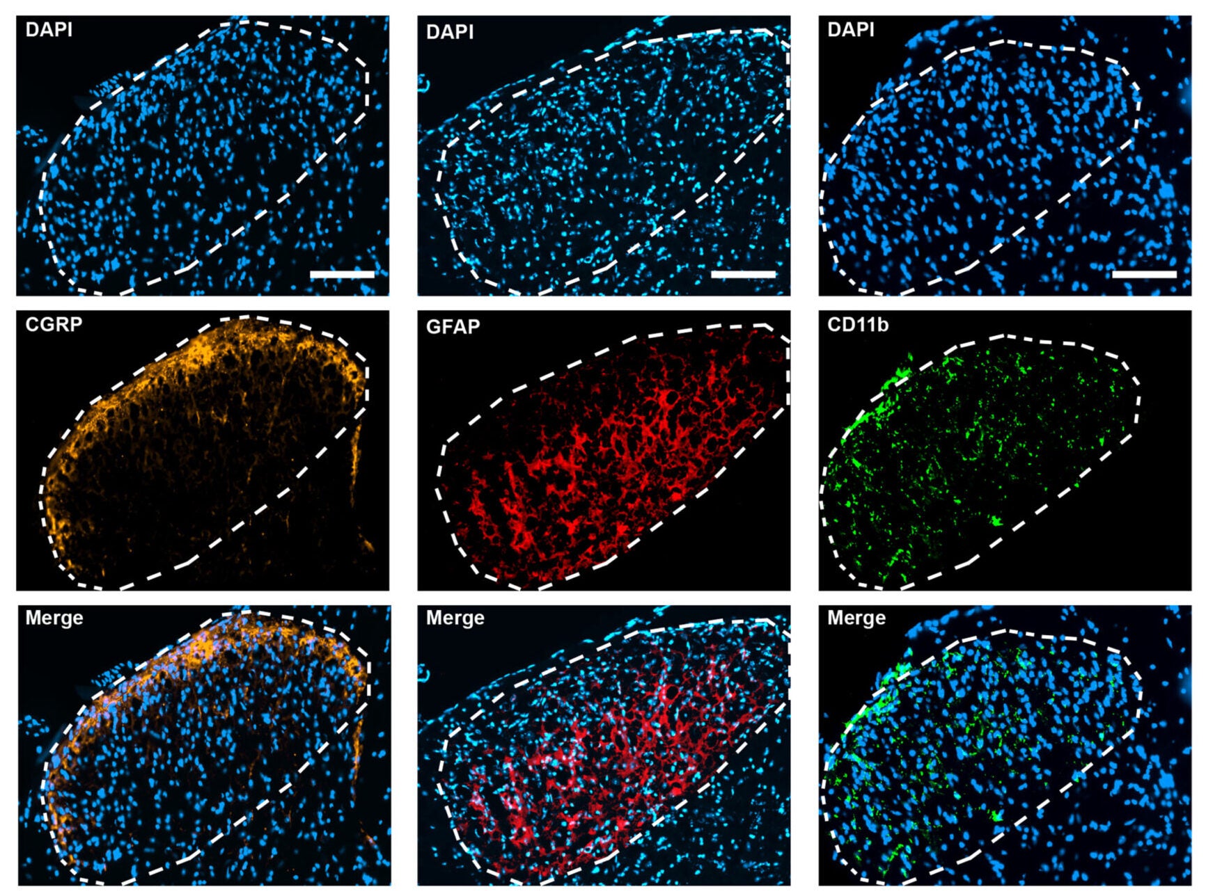 Representative images of calcitonin gene-related peptide (CGRP), glial fibrillary acidic protein (GFAP), and CD11b immunoreactivity in the dorsal horn of sparc−/− mice (delineated in a dashed line).