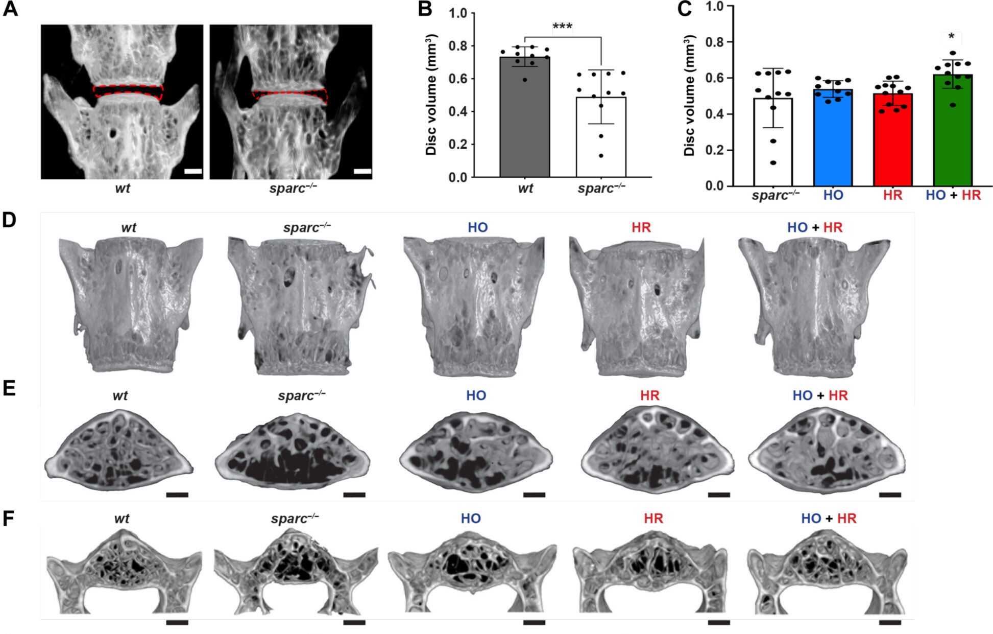 Treatment with senolytics resulted in increased IVD volume and improved bone quality.