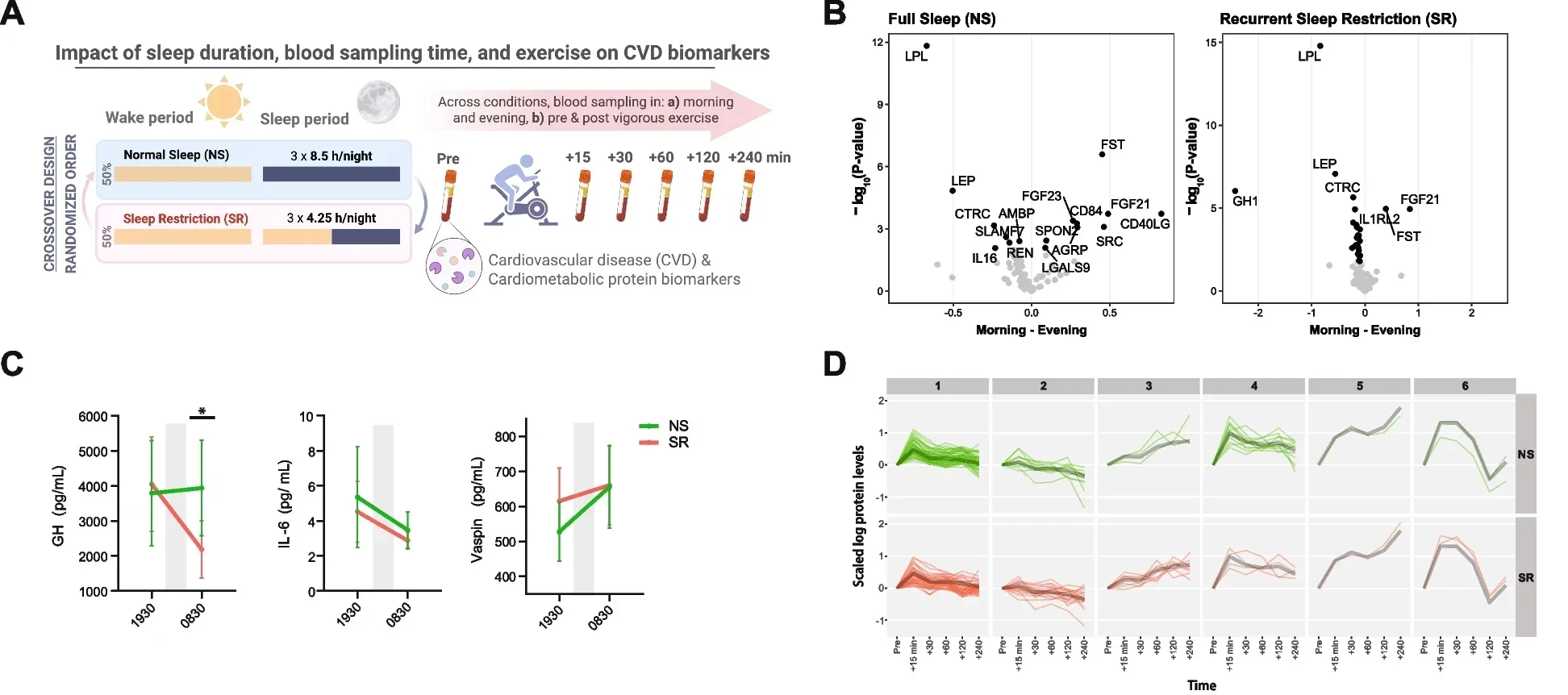 Sleep restriction, time of day and physical exercise dynamically modulate proteomic CVD biomarker levels