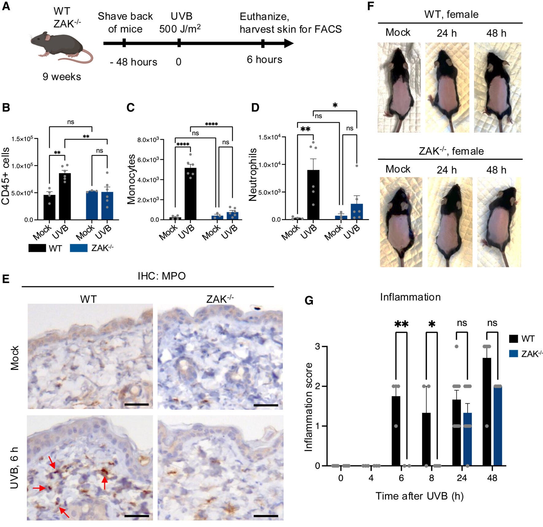 ZAK−/− mice are protected against early immune cell infiltration in UVB-irradiated skin.