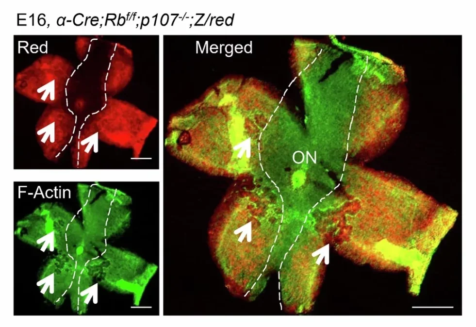 Tumor suppression without rescuing aberrant angiogenesis and apical polarity.