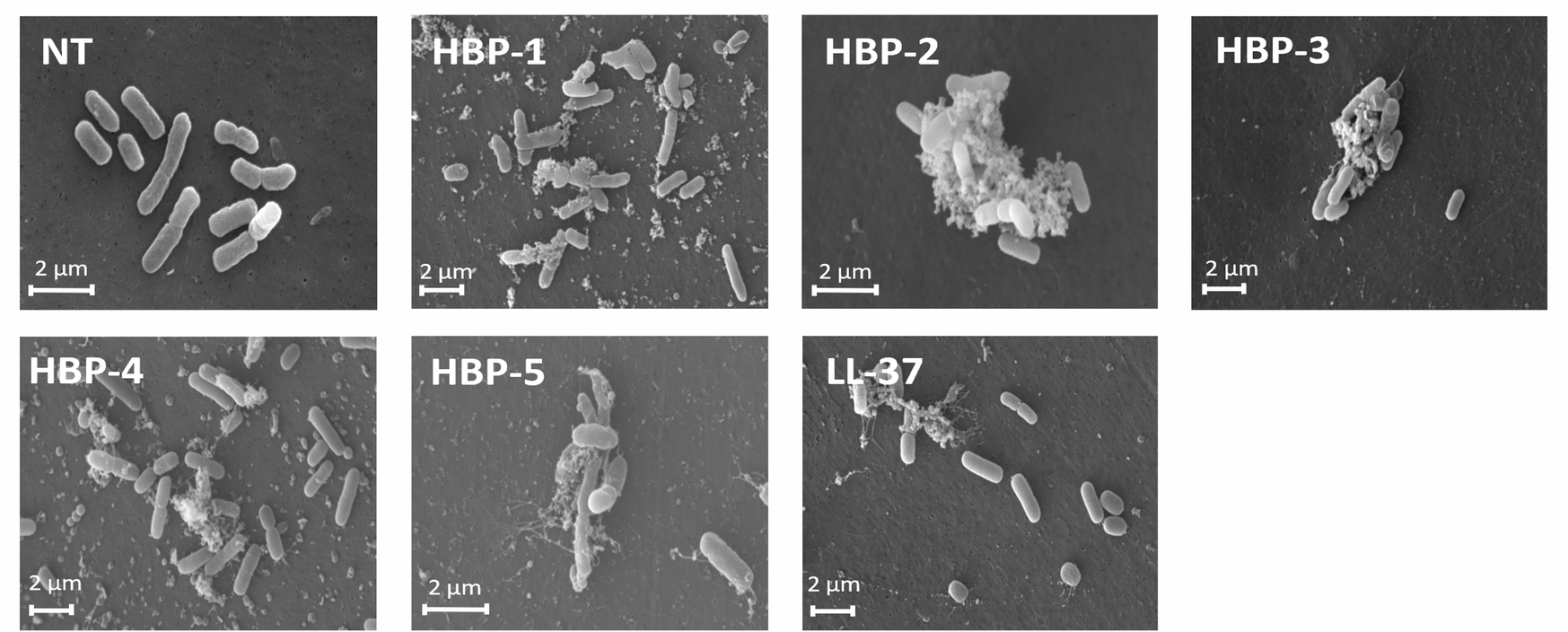 SEM pictures of E. coli cells treated with HBPs