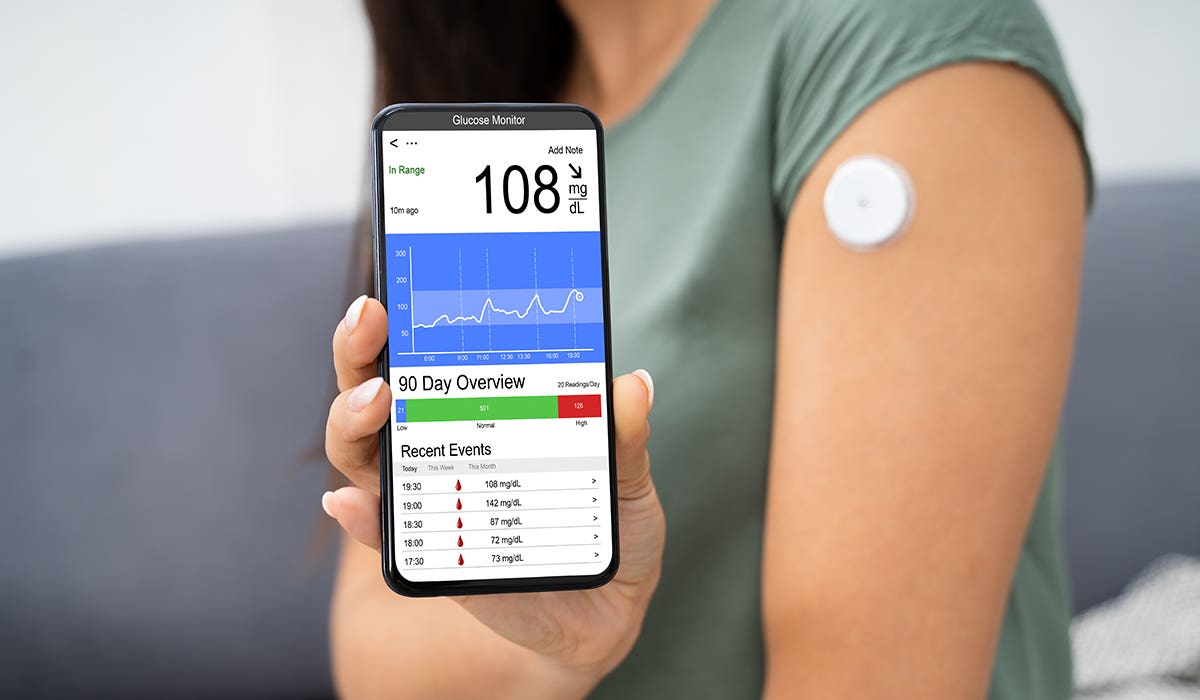 A new method using CGM data predicts diabetes risk better than standard tests, offering earlier and easier detection.