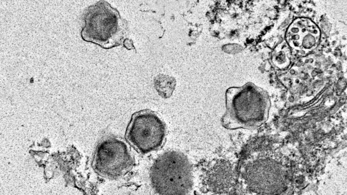 A giant virus infection of the unicellular algae Florenciella. The giant viruses can be seen bursting out of the Florenciella cell with their hexagon-shaped capsids that enclose their genetic material.