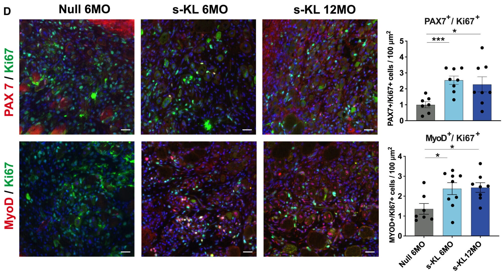 Quantification of double PAX7 and Ki67 positive cells (first row) and double MyoD and Ki67 positive cells (second row) found in the grafts.