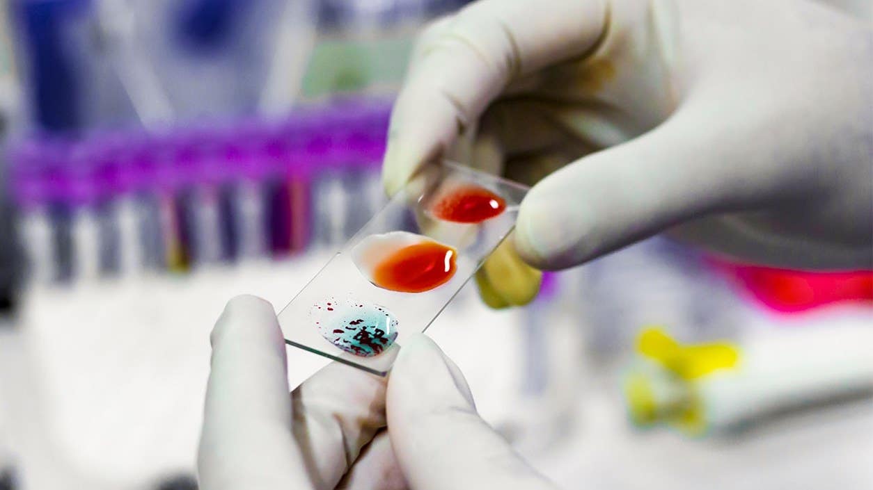 Scientists identify a new blood type, "Gwada negative," adding the 48th blood group system to human biology