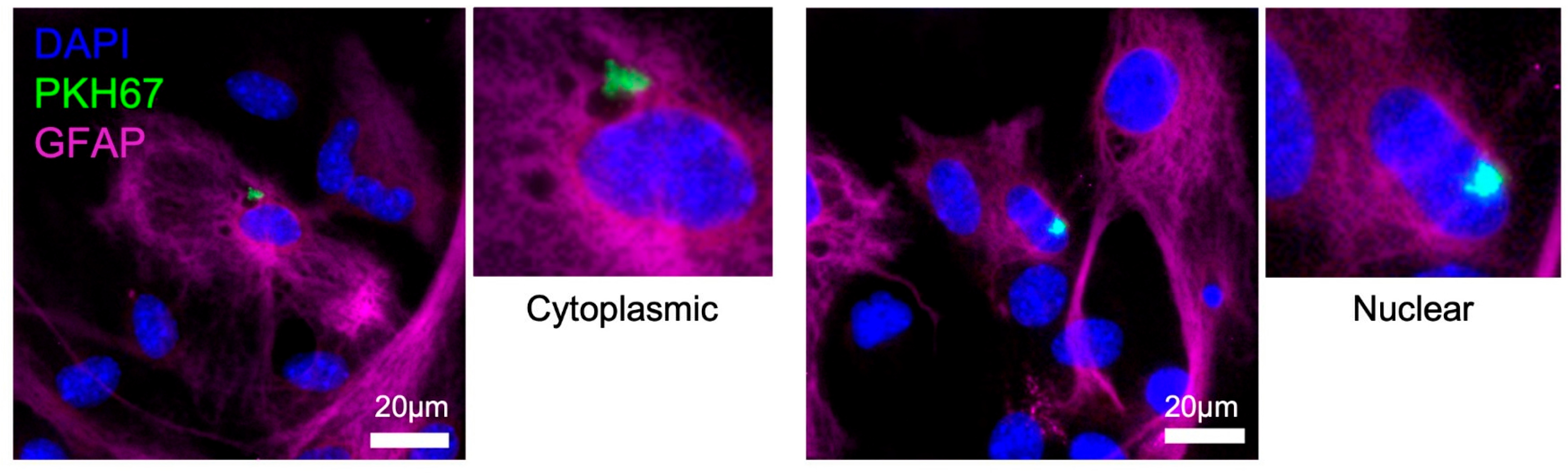 Fluorescent microscopy of astrocytes after the addition of EVs from uninfected and T. gondii infected neurons indicating the location of EVs in the cytoplasm versus nucleus.