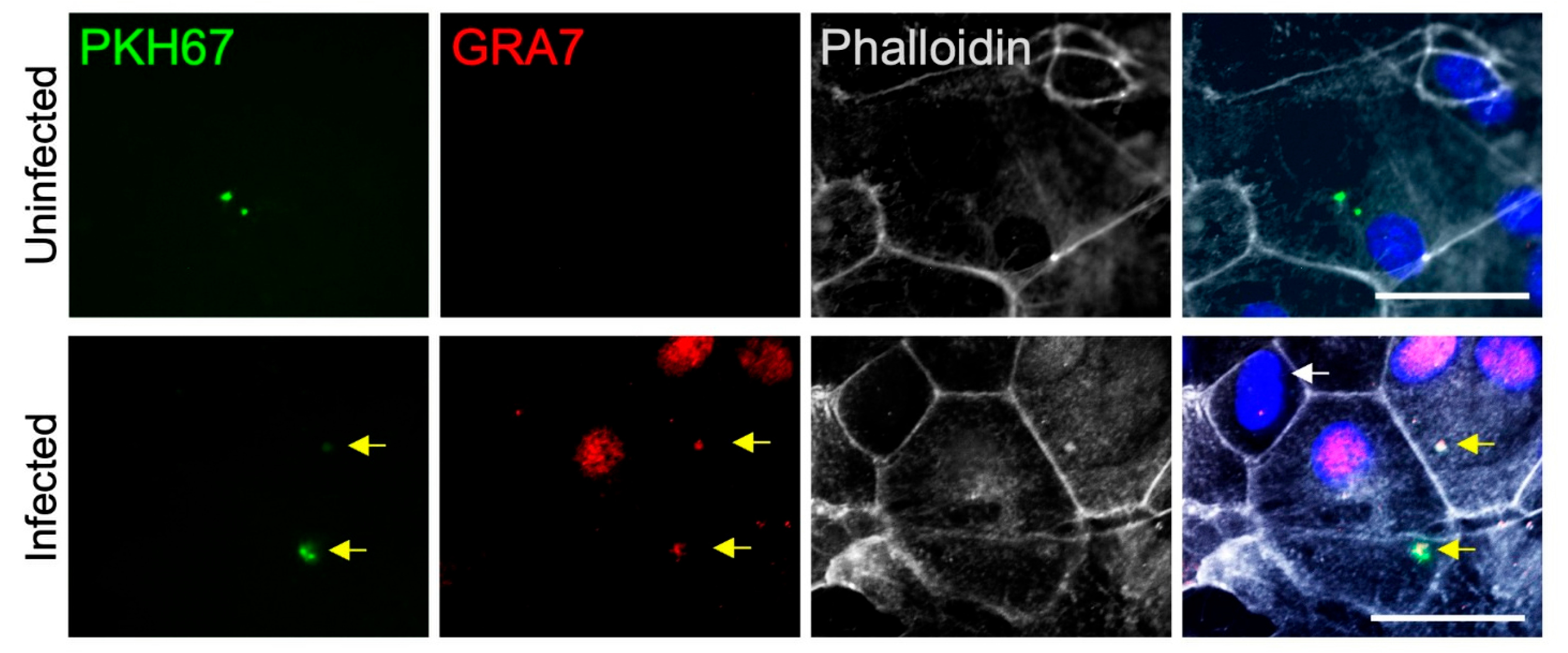 Permeabilization experiments on EVs and GRA7 protein. Yellow arrows are points to PKH67 + GRA7 + parasites that contain GRA7 + astrocyte nuclei.