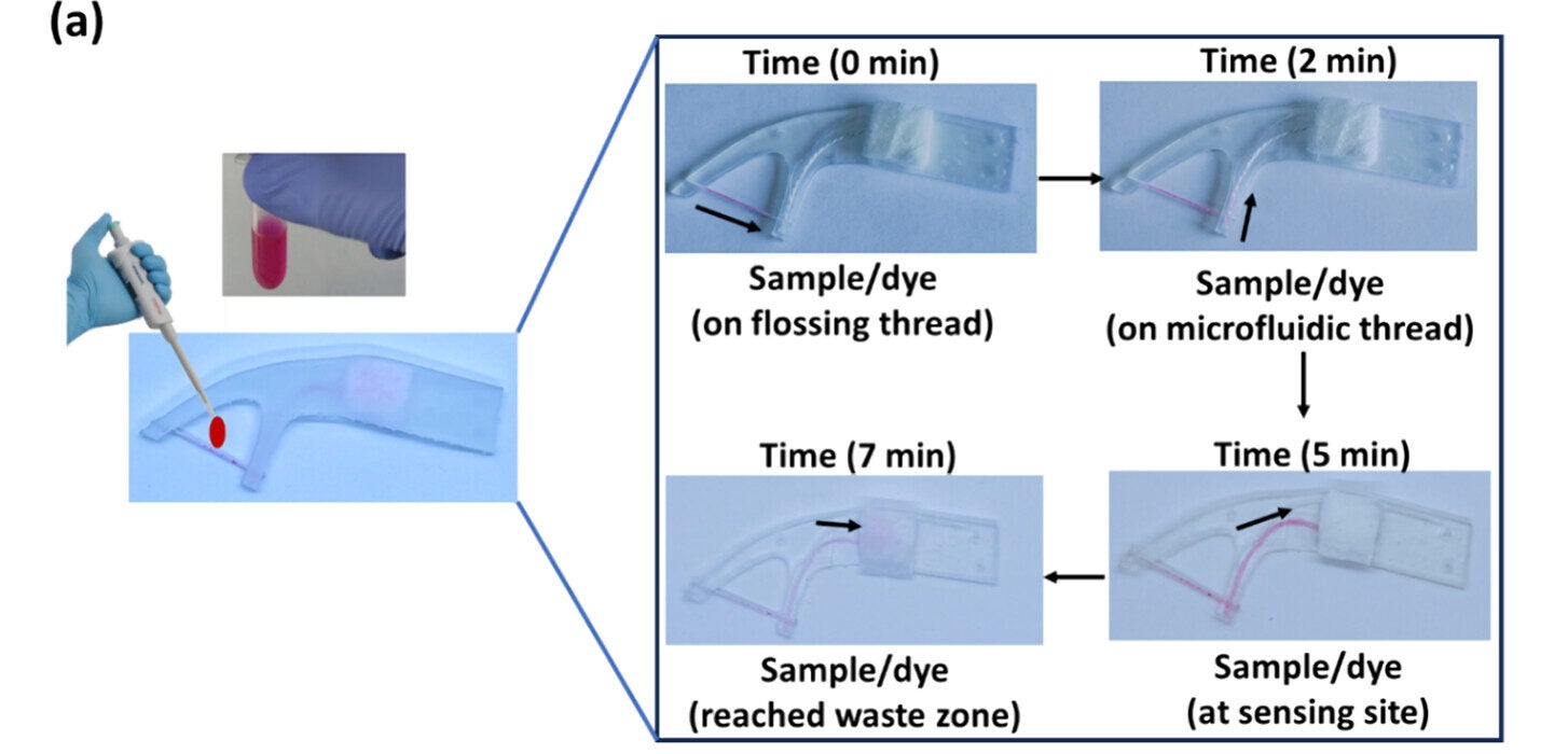 Demonstration of sampling (saliva, 0.10 mL) and flow of saliva from flossing site to waste zone using sulforhodamine B (SRB, a dye) for visual confirmation