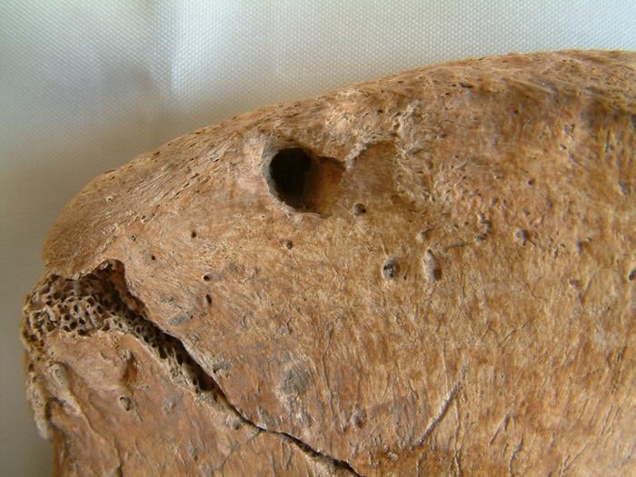 Lion tooth mark on the hip bone