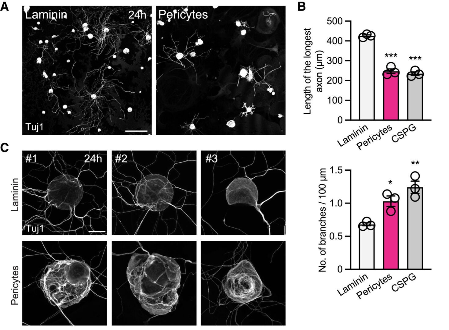 Pericytes cause detrimental structural and functional changes in adult DRG neurons
