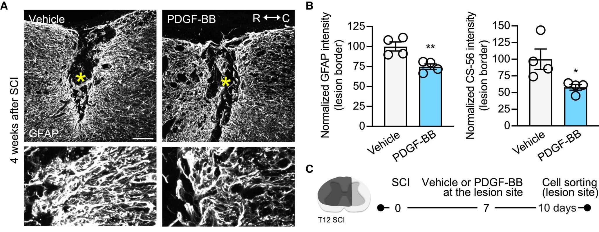 PDGF-BB localized delivery at the lesion site positively affects the physical and chemical nature of the lesion environment