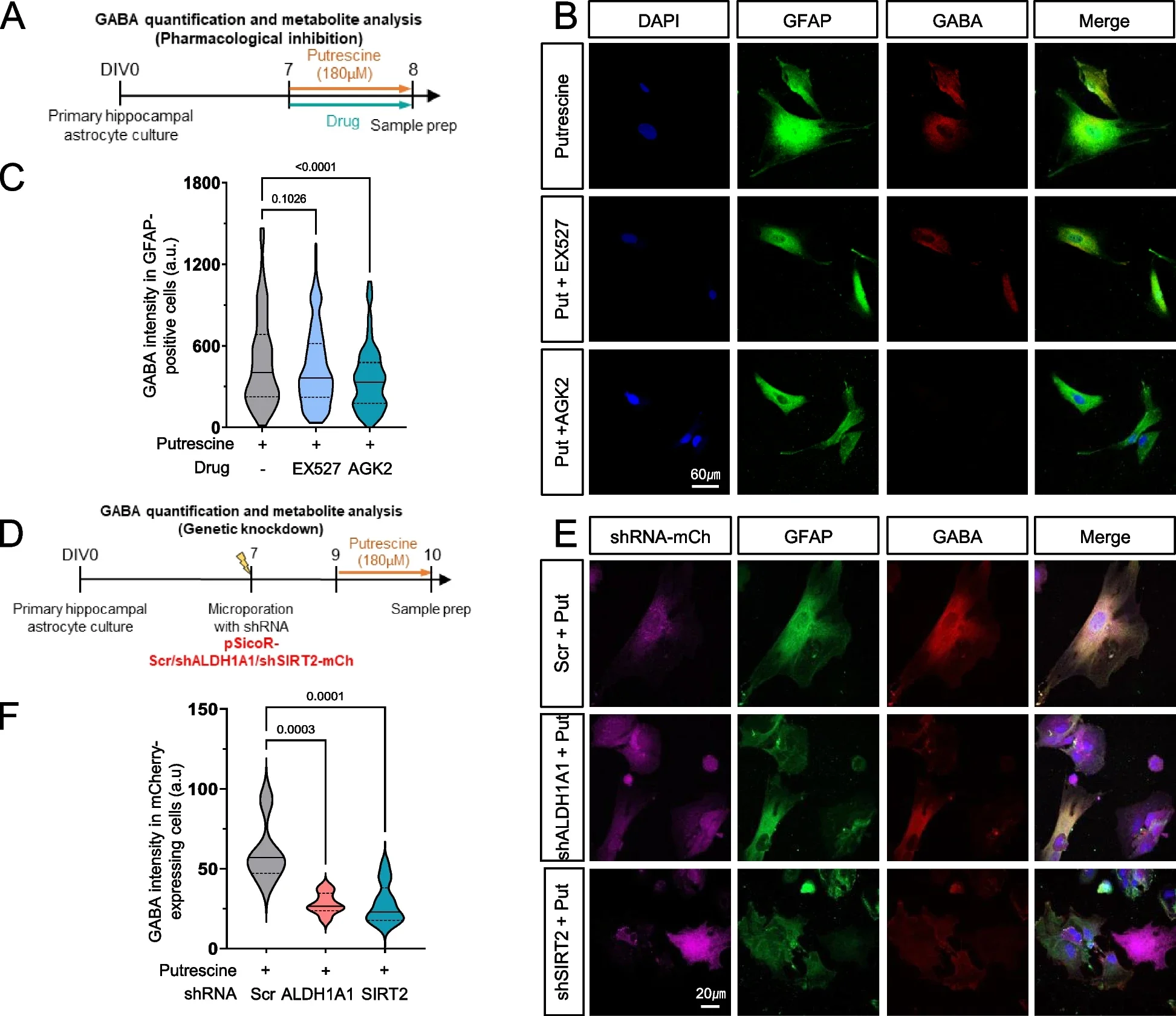 SIRT2 and ALDH1A1 are involved in the conversion of putrescine to GABA in astrocytes