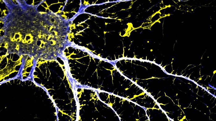A cortical neuron treated with JRT, a synthetic molecule similar to the psychedelic drug LSD. Drugs like JRT might enable new treatments for conditions such as schizophrenia, without the hallucinations and other side effects of psychedelics. 


