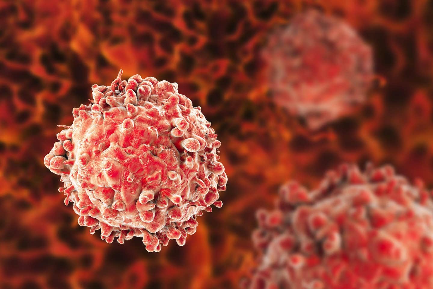 A new drug combo forces leukemia cells to mature, extending survival and reducing toxicity in acute myeloid leukemia.