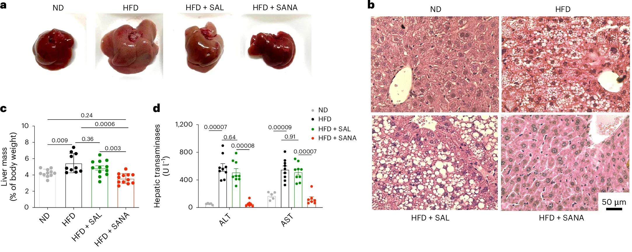 SANA protects against glucose intolerance and liver steatosis in response to DIO.