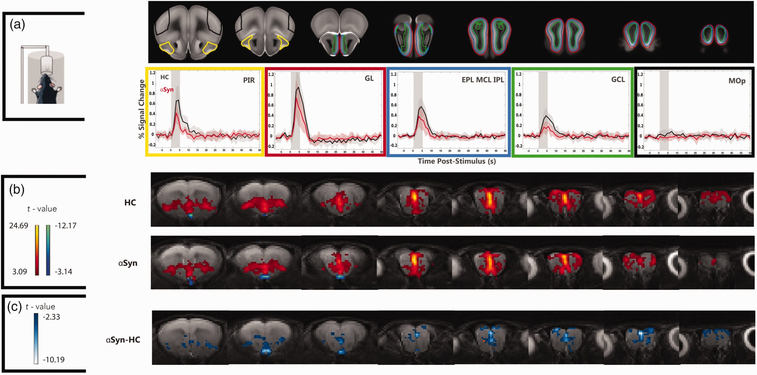 Olfactory fMRI in human 
aSyn tg mice reveals decreased activation compared to healthy controls.