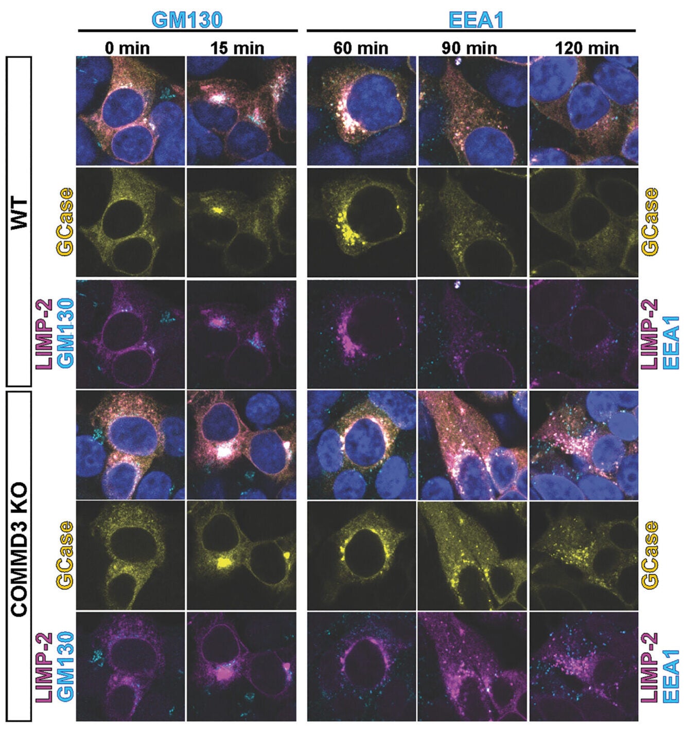 Immunofluorescence images of eGFP-GBA-SBP (deep yellow) and SBP-mCherry-LIMP2 (magenta) at the indicated time points following treatment with 40-μM biotin. GM130 (cyan) was used as a Golgi marker in 0- and 15-min panels, and EEA1 (cyan), as an early endosome marker in 60-, 90-, and 120-min panels.