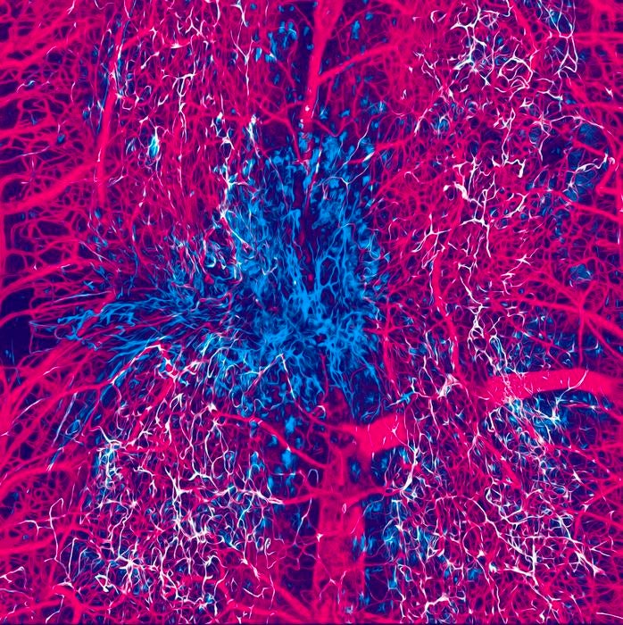 Pericytes, in blue, and vasculature, in pink, at the lesion site one month after a spinal cord injury in an adult mouse.