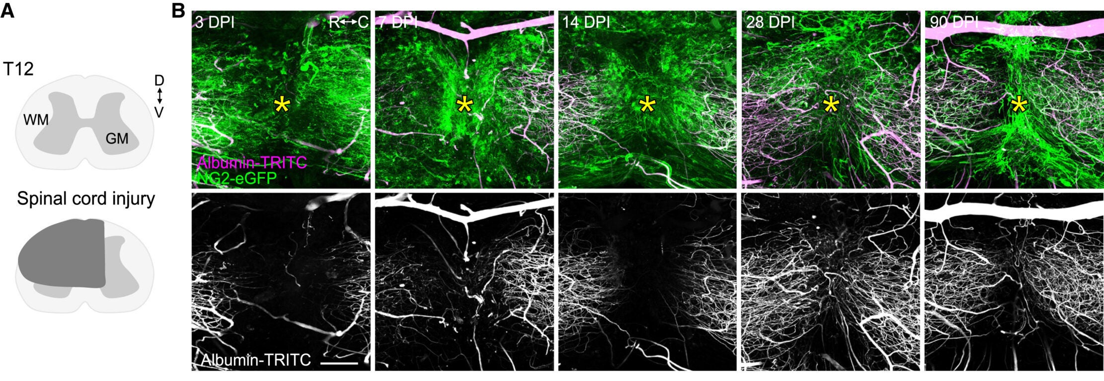 SCI leads to profound changes in vasculature architecture and pericyte coverage.
