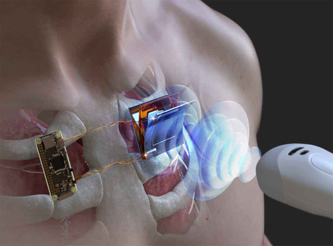 New flexible device uses ultrasound to power medical implants, offering safe and efficient wireless charging deep in the body.