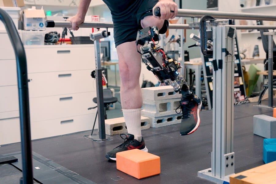 Using an osseointegrated mechanoneural prosthesis, the subject actively bends and straightens their phantom knee to step over an obstacle in their path.