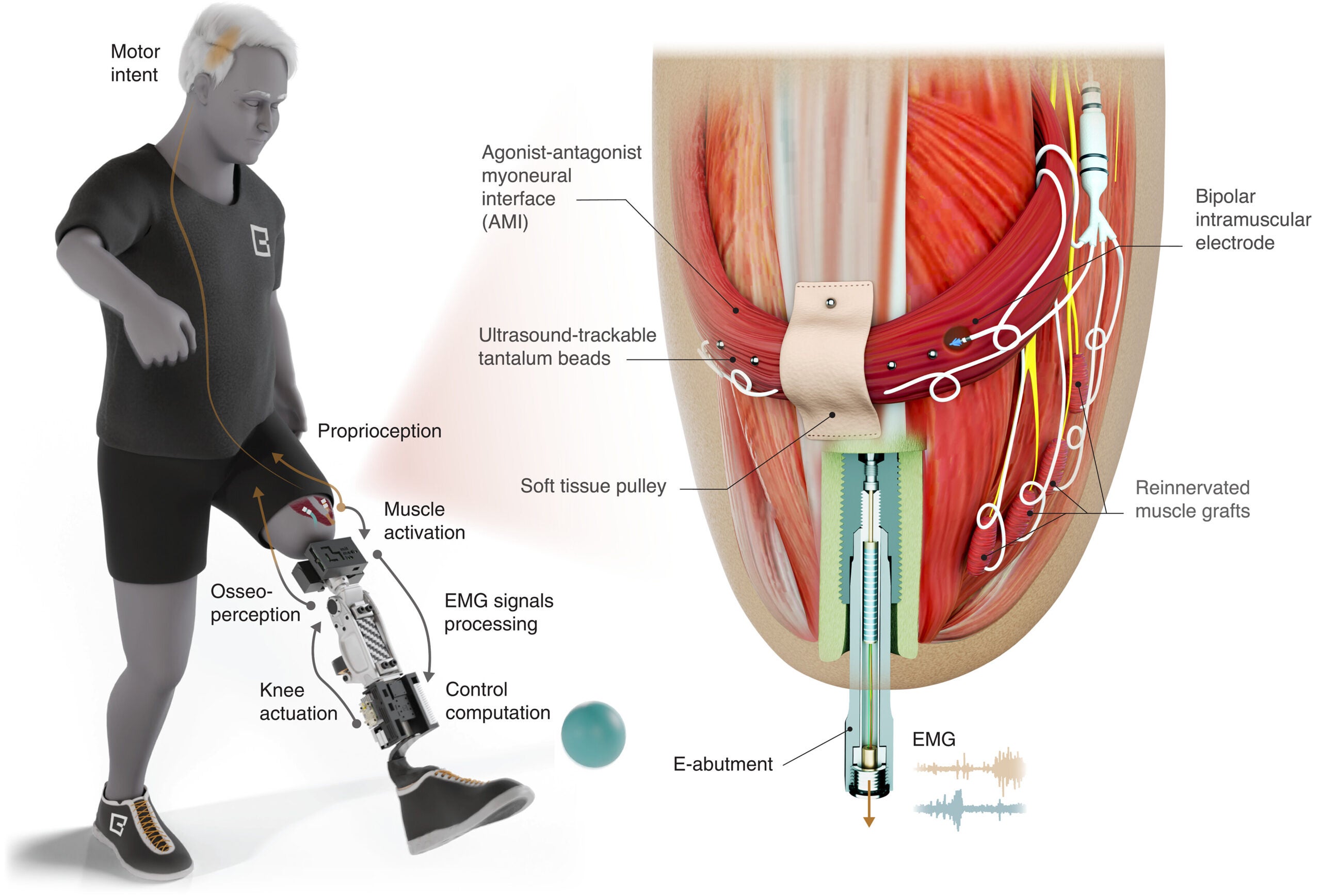 The osseointegrated mechanoneural prosthesis sustains continuous knee control from motor intent originating in the central nervous system.