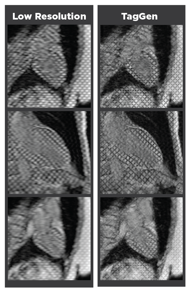 An infographic comparing low resolution MRI images to imaging enhanced by the model TagGen.