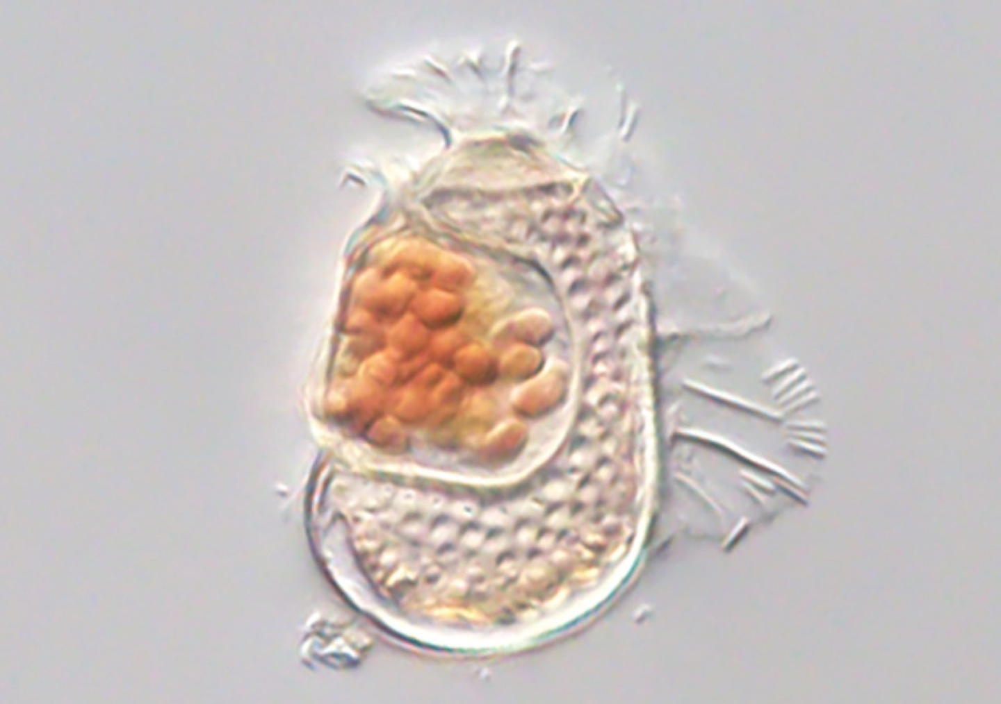 A newly discovered archaeon with a genome smaller than some viruses is redefining the limits of cellular life.