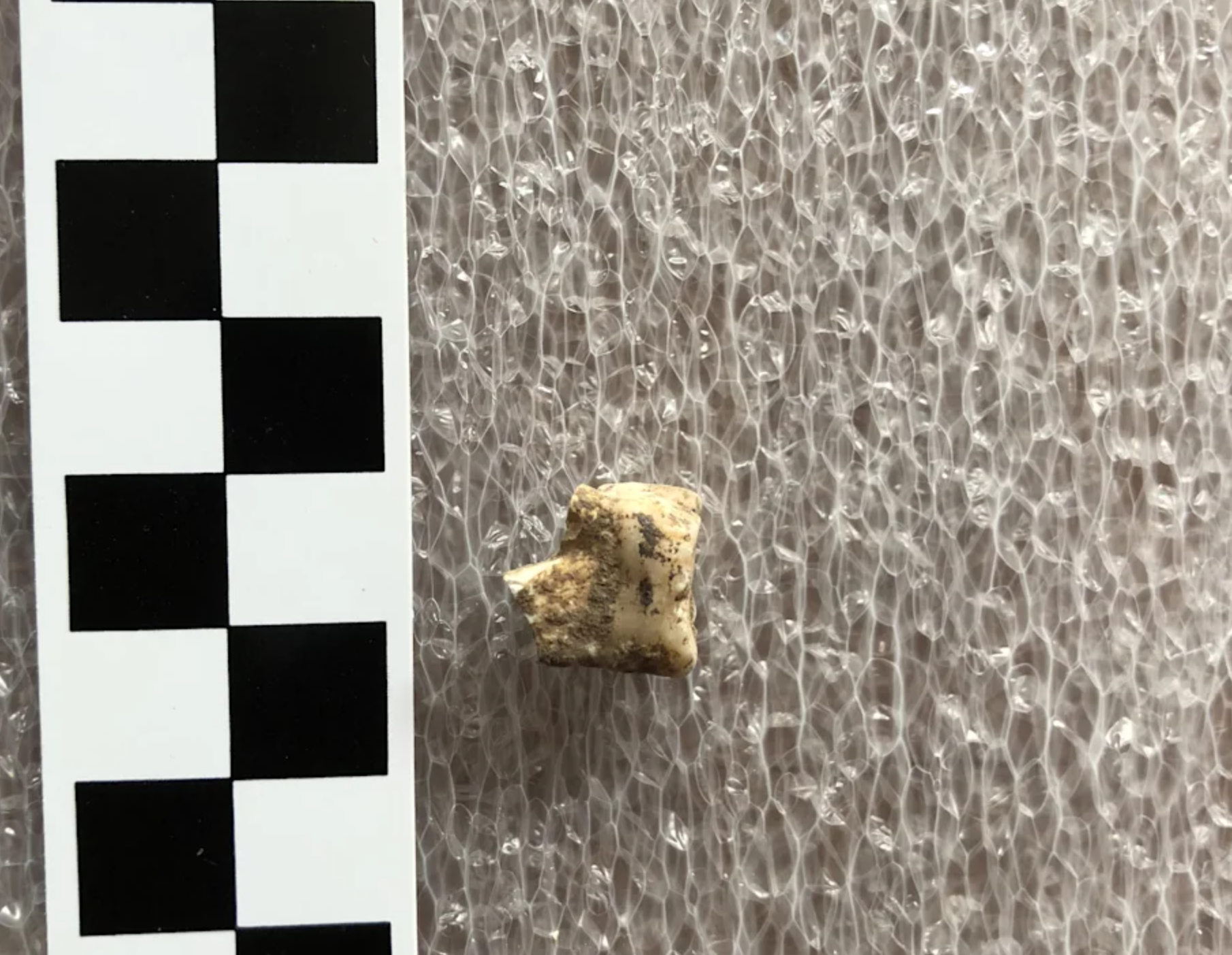 Tooth from Burial 11 from which the team retrieved dental calculus. 