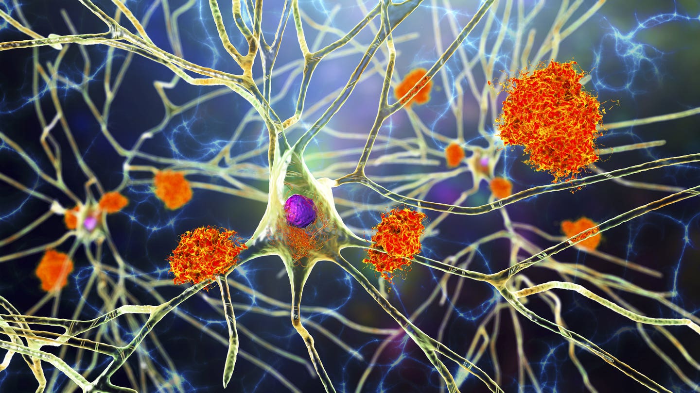 A Johns Hopkins study has uncovered over 200 misfolded proteins linked to memory loss in aging rats, pointing to new treatment paths.