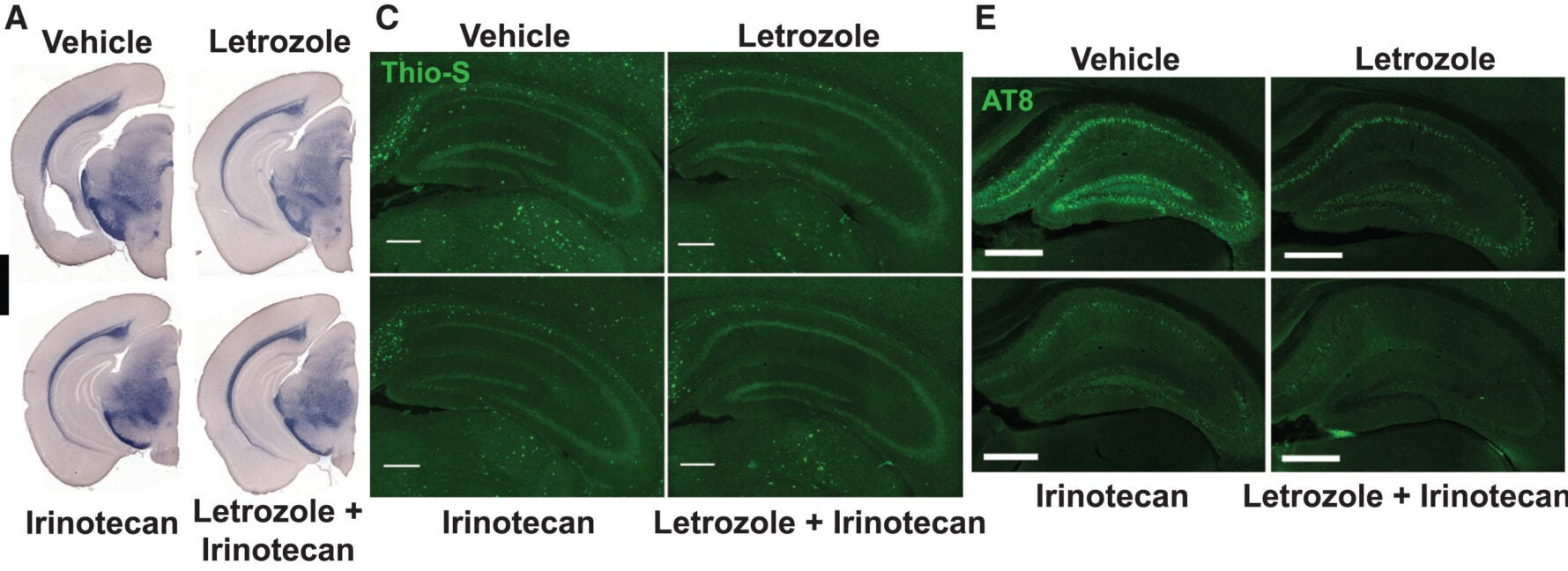 AD pathologies are significantly reduced in aged 5×FAD/PS19 mice after drug treatments, with the strongest rescue in the combination-treatment group