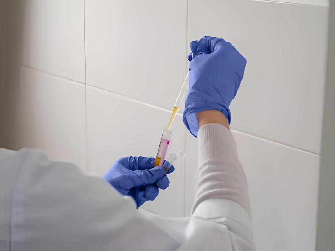 A simple blood test measuring apoB could reveal hidden heart disease risks missed by standard cholesterol checks, offering earlier, life-saving insights.