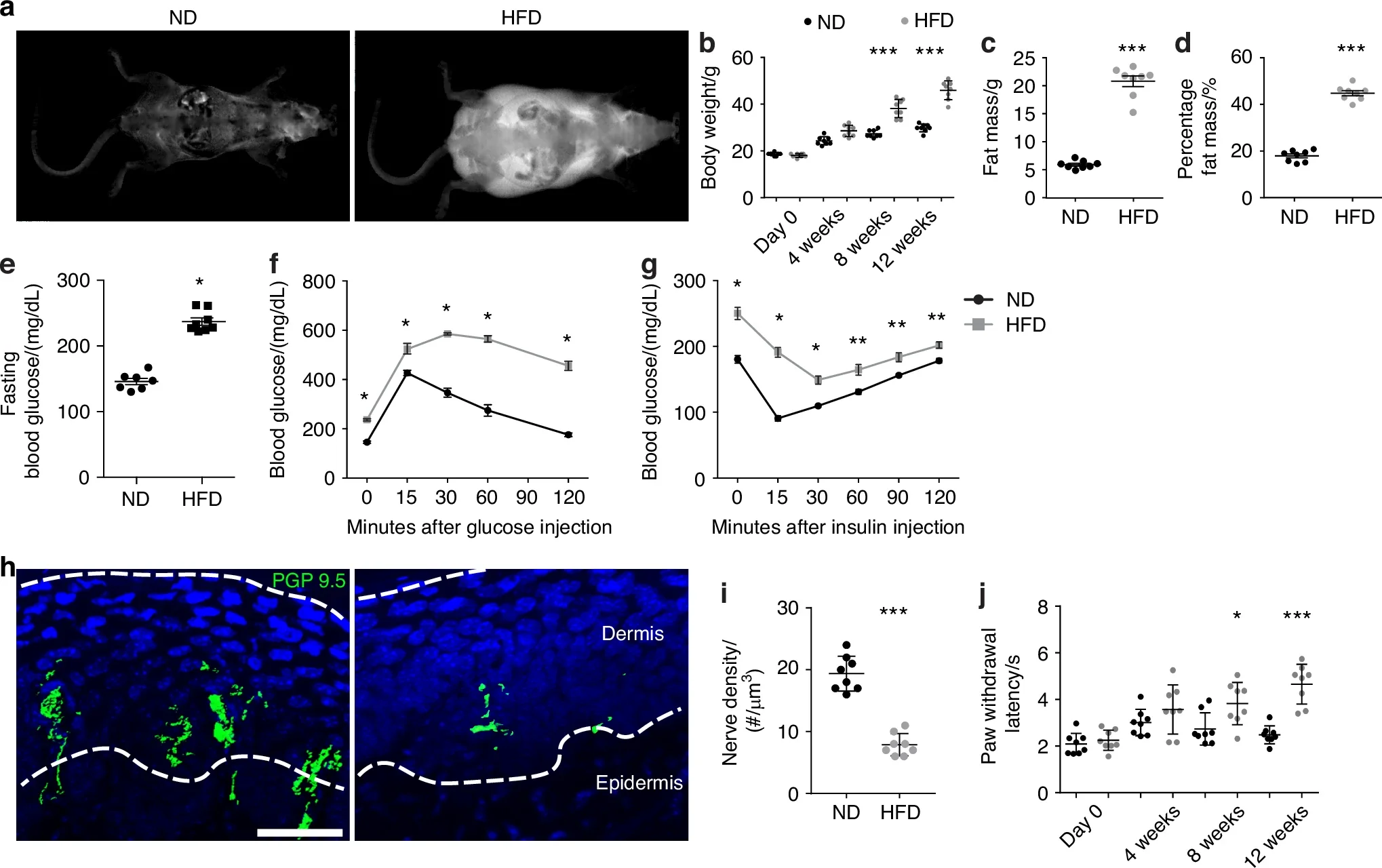 High-fat diet (HFD) feeding induces obesity, glucose intolerance, insulin resistance, and peripheral neuropathy.
