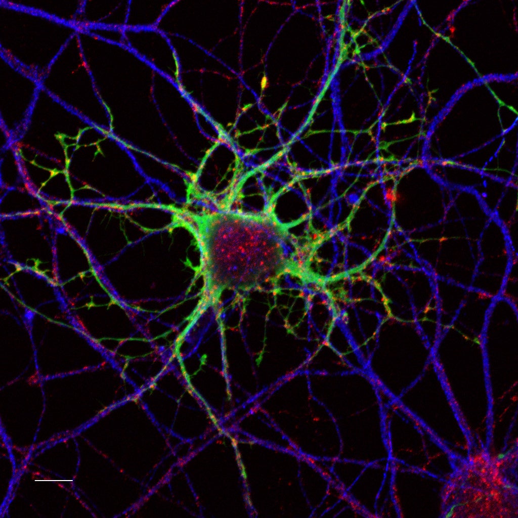 Researchers observed a decrease in nerve cell density in periosteum of HFD-fed mice