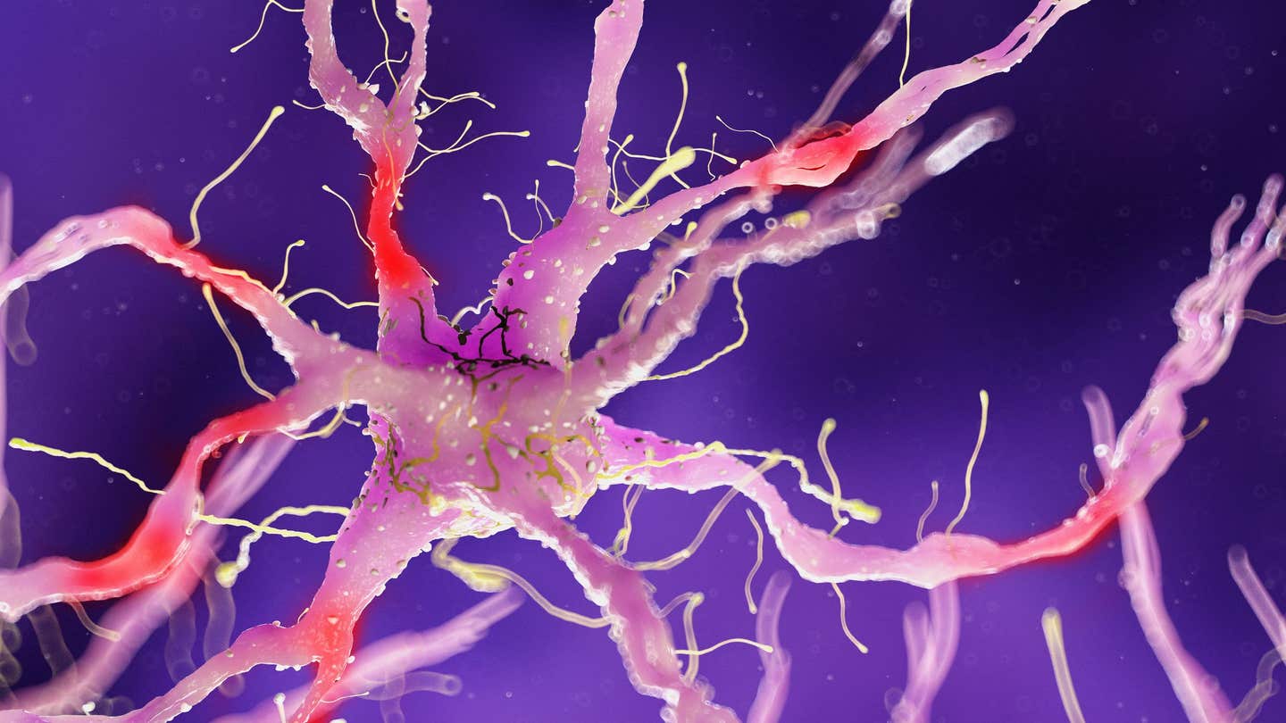 New study reveals how diabetes-related nerve damage weakens bones and may raise fracture risk.