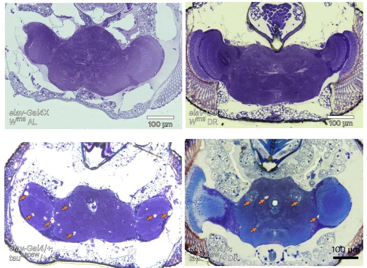 DR protects against neurodegeneration and extends lifespan in tau flies.
