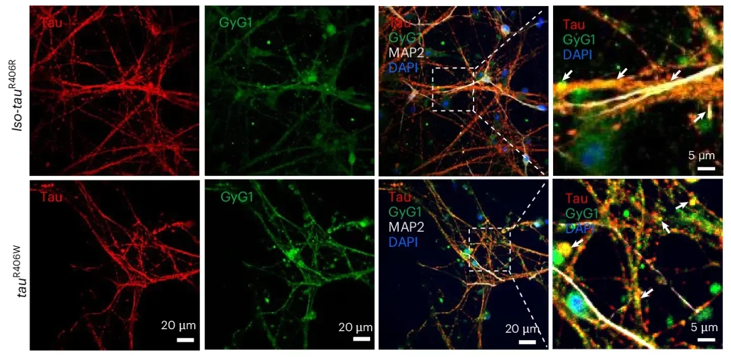 Glycogen metabolism is altered in human iPSC-derived neurons from people with tauopathy.