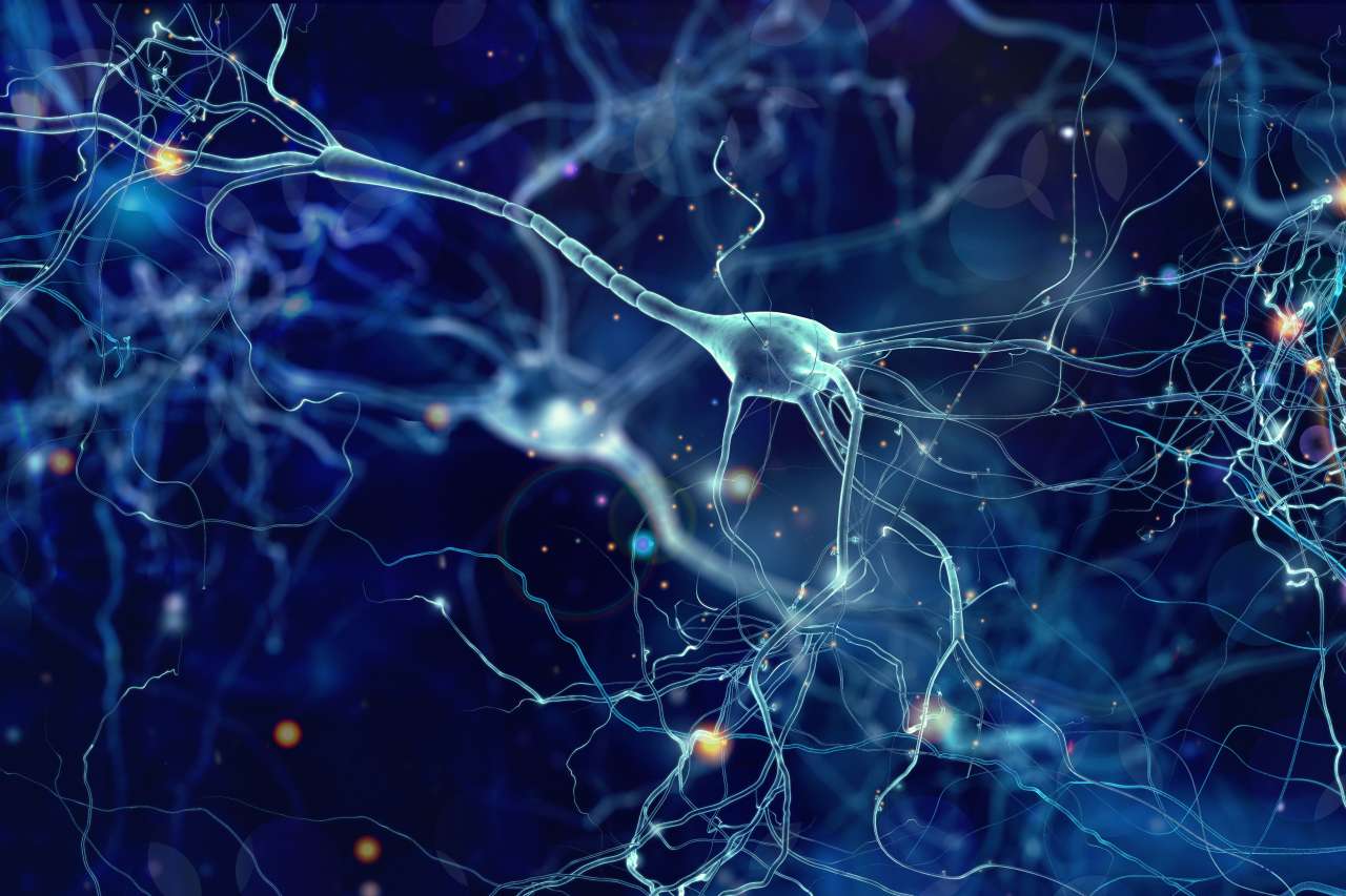 Neurons in the human brain. Alzheimer's disease unfolds through a complex series of health events that occur over time.