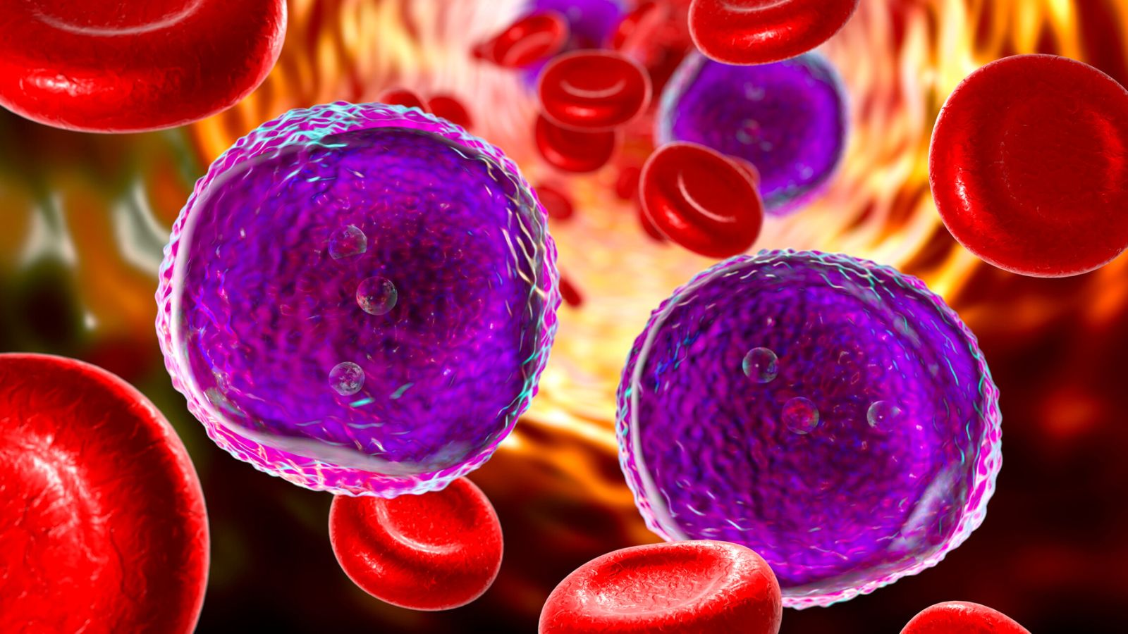 Researchers asked a simple question: if breath reflects what's happening in the blood, could it also reflect blood cancer?