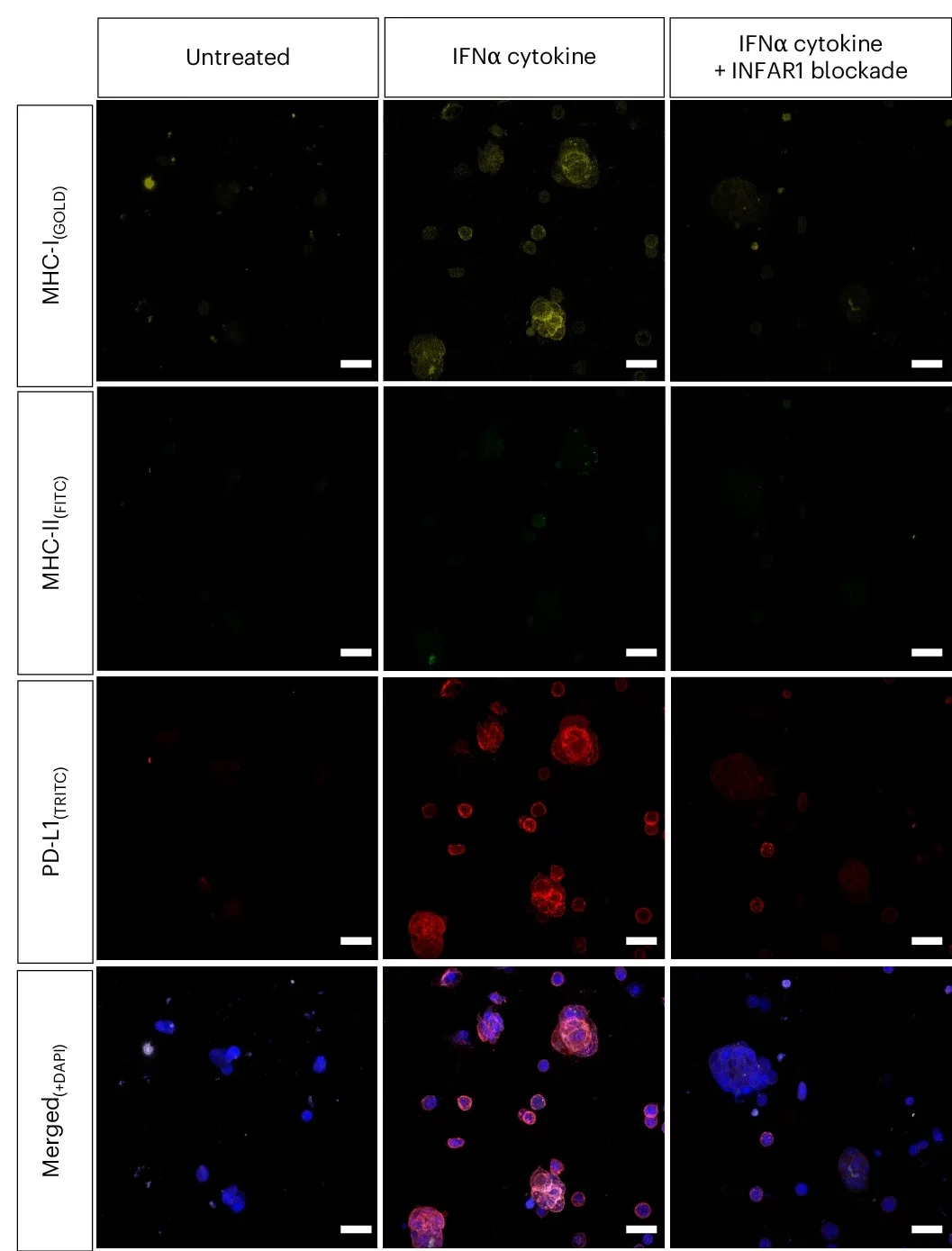 Immunofluorescence images depicting MHC-I, PD-L1 and MHC-II expression in 3D spheroids of B16F0 melanoma treated with IFNα cytokine with and without IFNAR1 mAbs.