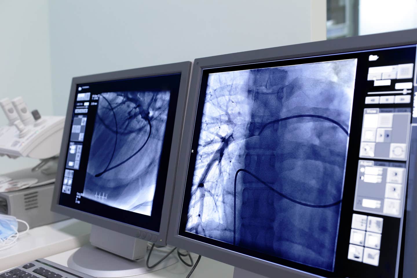 AI tool sharpens blurry heart scans and cuts MRI time by 90%, helping doctors diagnose heart problems faster and more clearly. (CREDIT: iStock)