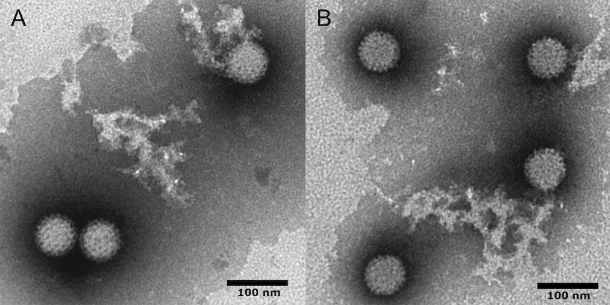 Image of mammalian orthoreovirus type 3.