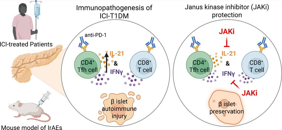 Graphical abstract. Immune checkpoint inhibitors (ICI) have revolutionized cancer therapy, but their use is limited by the development of autoimmunity in healthy tissues as a side effect of treatment. 