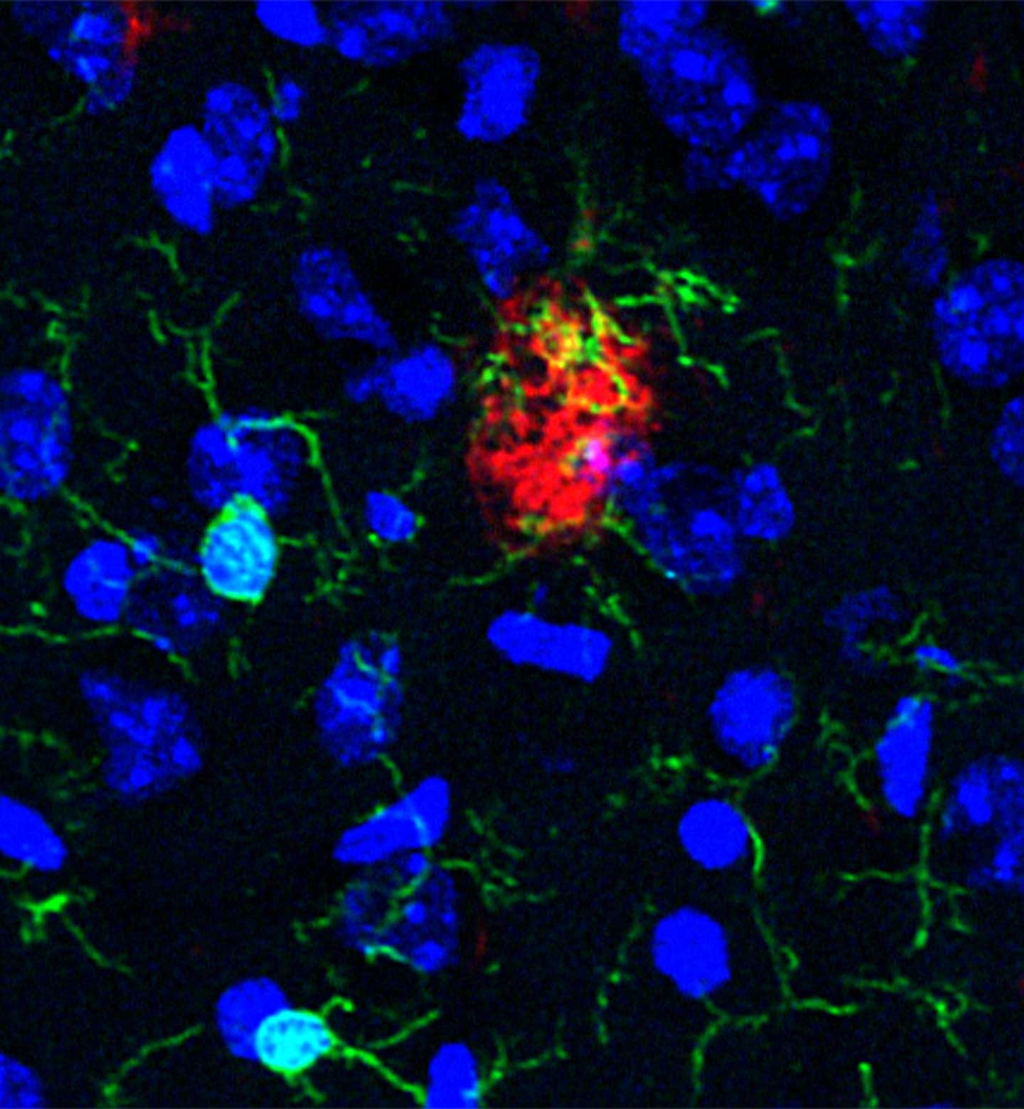 Microscopy showing blue cell nuclei, green microglia, and red amyloid beta plaques.