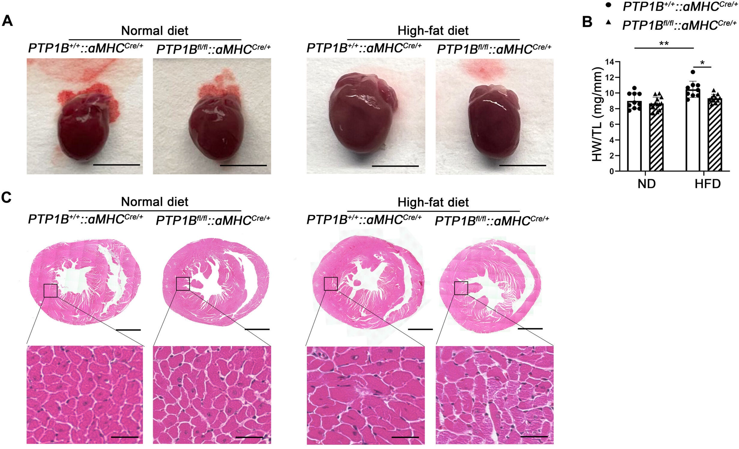 CM-specific deletion of PTP1B prevents HFD-induced cardiomyopathy.