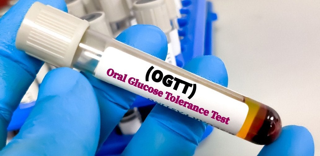 Blood Glucose Levels after Glucose Intake Linked to Increased Life Expectancy