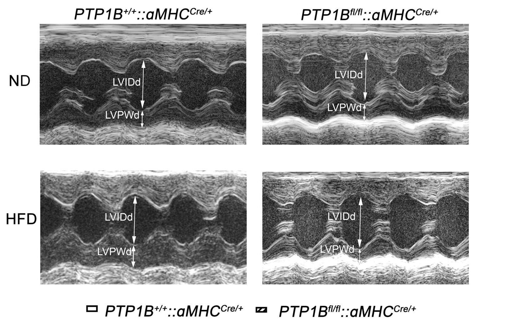 CM-specific PTP1B deletion preserves cardiac function in response to HFD.