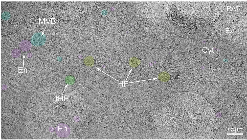 Cryo-electron tomography observation of hemifused vesicles at the leading edge of cultured cells.