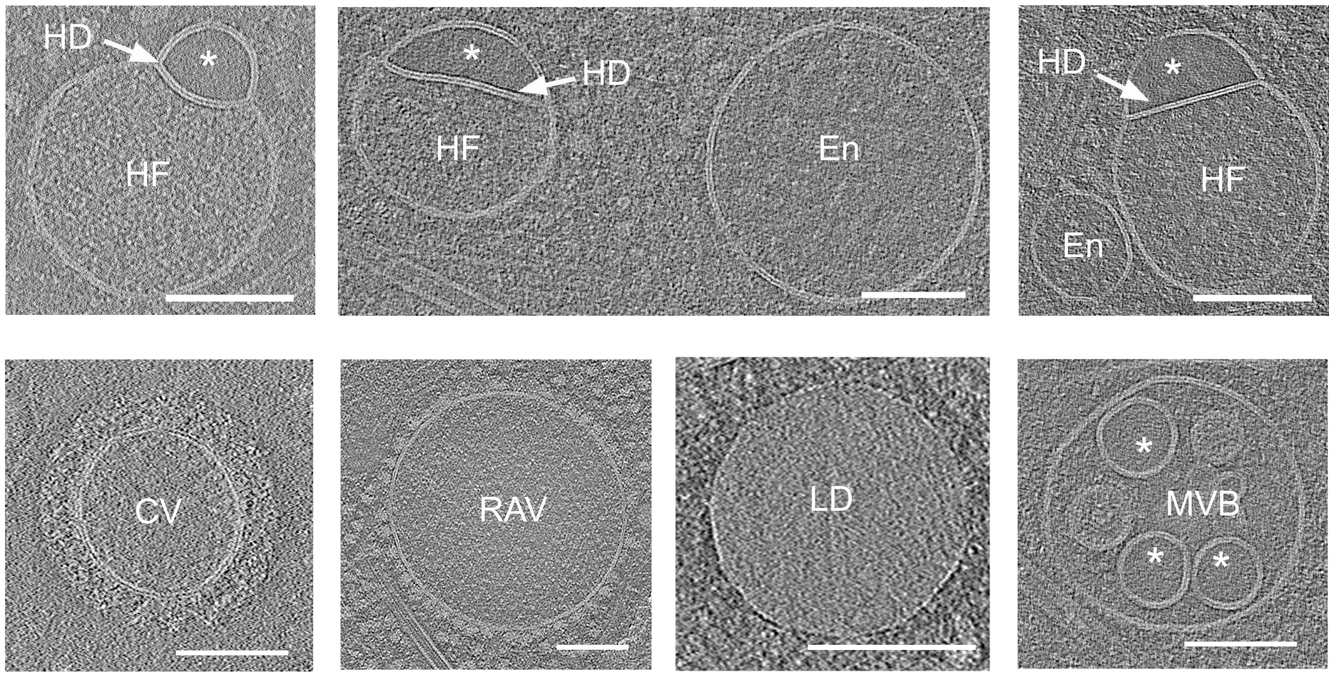 Hemifusome luminal content is distinct from other membrane-bound organelles.